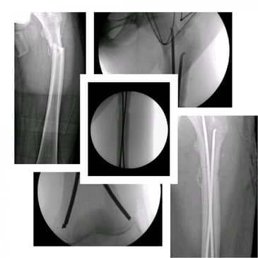 Slider image (4) Dr. Rodrigo Aguirre Rojas Orthopedic Surgeon